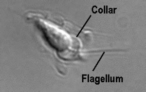  Choanoflagellate: A Microscopic Wanderer with a Whimsical Collar!