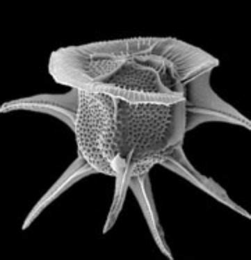  Neoceratium:  Are You Ready To Dive Deep into The Microscopic World of These Dazzling Dinoflagellates?